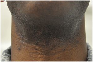 L’Esercito USA: barbe a rischi - verso l’addio alle deroghe permanenti alla rasatura - difesanews.com L’Esercito USA: barbe a rischi - verso l’addio alle deroghe permanenti alla rasatura - difesanews.com